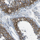 Immunohistochemical staining of human testis shows strong cytoplasmic positivity in cells in seminiferous ducts.