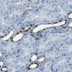 Immunohistochemical staining of human kidney shows strong cytoplasmic positivity in cells in tubules.