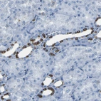 Immunohistochemical staining of human kidney shows strong cytoplasmic positivity in cells in tubules.