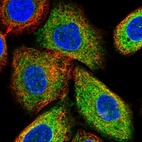 Immunofluorescent staining of human cell line A549 shows localization to endoplasmic reticulum.