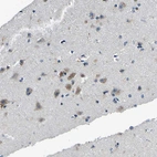 Immunohistochemical staining of human cerebral cortex shows weak cytoplasmic positivity in neurons.