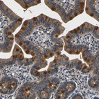 Immunohistochemical staining of human upper gastrointestinal shows moderate cytoplasmic positivity in glandular cells.
