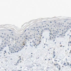 Immunohistochemical staining of human skin shows very weak cytoplasmic positivity in a small subset of squamous epithelial cells.