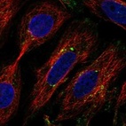 Immunofluorescent staining of human cell line SiHa shows localization to the Golgi apparatus.