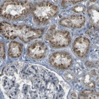 Immunohistochemical staining of human kidney shows moderate granular cytoplasmic positivity in cells in tubules.