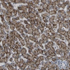 Immunohistochemical staining of human liver shows strong granular cytoplasmic positivity in hepatocytes.
