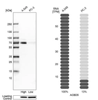 Western blot analysis in human cell lines A-549 and PC-3 using Anti-ACBD5 antibody. Corresponding ACBD5 RNA-seq data are presented for the same cell lines. Loading control: Anti-HSP90B1.