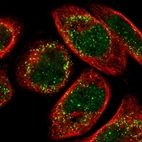 Immunofluorescent staining of human cell line A-431 shows localization to nucleus & peroxisomes.