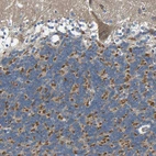 Immunohistochemical staining of human cerebellum shows strong cytoplasmic positivity in cells in granular layer.