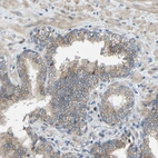 Immunohistochemical staining of human prostate shows weak cytoplasmic/ membranous positivity in glandular cells.