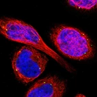 Immunofluorescent staining of human cell line A-431 shows localization to vesicles.