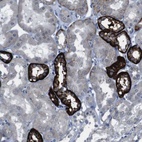 Anti-CDH22 Antibody