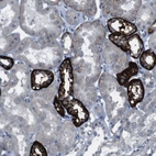 Anti-CDH22 Antibody