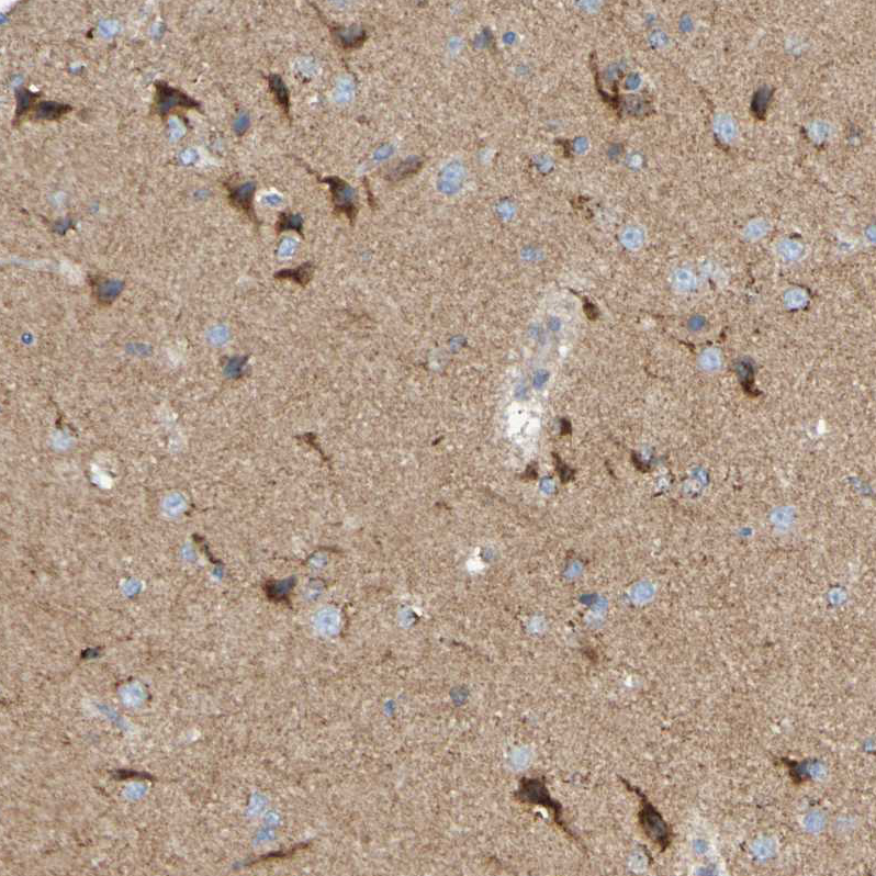 Anti-LMBRD2 Antibody