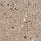 Anti-LMBRD2 Antibody