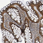 Immunohistochemical staining of human colon shows strong cytoplasmic positivity in glandular cells.