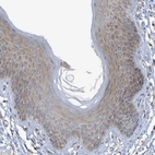 Immunohistochemical staining of human skin shows weak cytoplasmic positivity in squamous epithelial cells.