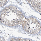 Immunohistochemical staining of human testis shows weak cytoplasmic positivity in cells in seminiferous ducts.