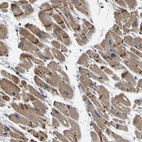 Immunohistochemical staining of human heart muscle shows moderate cytoplasmic positivity, as well as strong immunoreactivity in intercalated discs of cardiomyocytes.