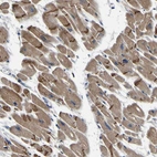 Immunohistochemical staining of human heart muscle shows moderate cytoplasmic positivity, as well as strong immunoreactivity in intercalated discs of cardiomyocytes.