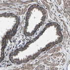 Immunohistochemical staining of human prostate shows strong cytoplasmic and membranous positivity in glandular cells.