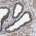 Immunohistochemical staining of human prostate shows strong cytoplasmic and membranous positivity in glandular cells.