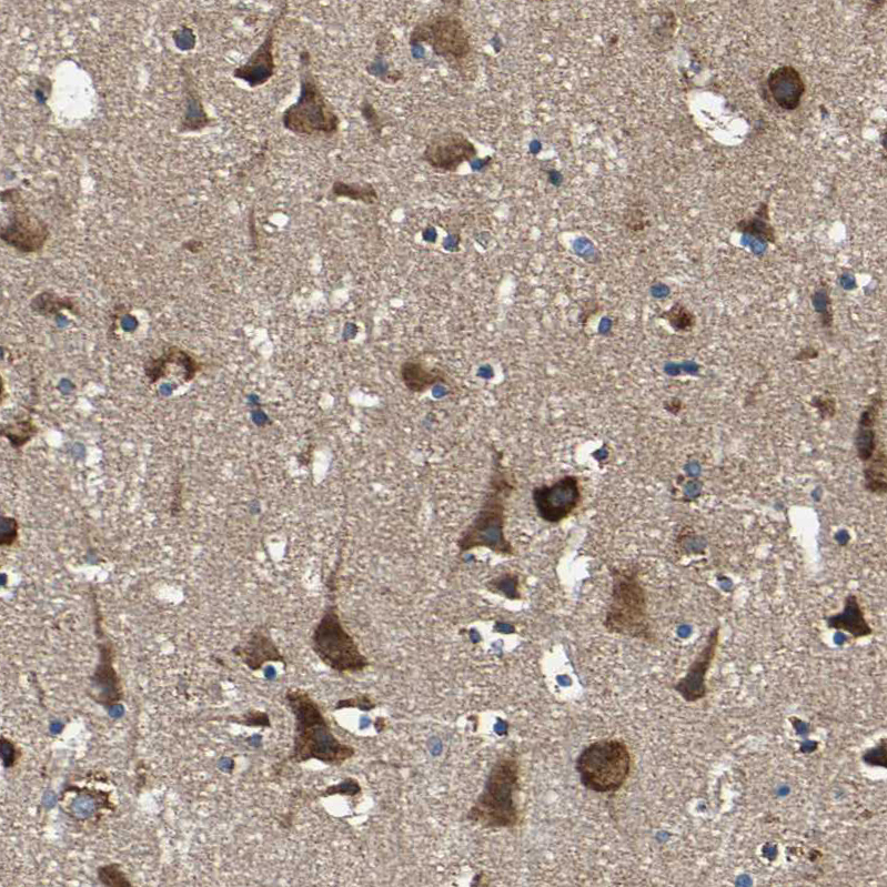 Rabbit Polyclonal Anti-INPP5A Antibody - Buy for research - Highly ...
