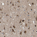 Immunohistochemical staining of human cerebral cortex shows strong cytoplasmic positivity in neurons.