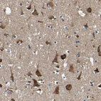 Immunohistochemical staining of human cerebral cortex shows strong cytoplasmic positivity in neurons.