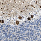 Anti-NOCT Antibody