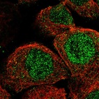 Immunofluorescent staining of human cell line A-431 shows localization to nucleoplasm & cytosol.