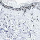 Anti-SP1 Antibody