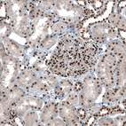 Anti-SP1 Antibody