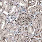 Immunohistochemical staining of human kidney shows strong nuclear positivity in cells in glomeruli.