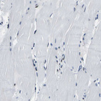 Immunohistochemical staining of human skeletal muscle shows weak nuclear positivity in myocytes.
