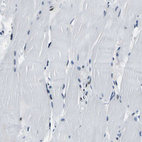 Anti-SP1 Antibody