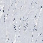 Immunohistochemical staining of human skeletal muscle shows weak nuclear positivity in myocytes.
