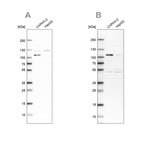 Western blot analysis using Anti-SP1 antibody HPA012292 (A) shows similar pattern to independent antibody HPA001853 (B).