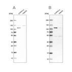 Western blot analysis using Anti-SP1 antibody HPA012292 (A) shows similar pattern to independent antibody HPA001853 (B).