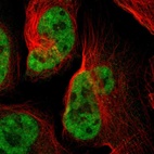 Immunofluorescent staining of human cell line U-2 OS shows localization to nucleoplasm.