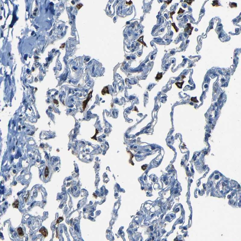 Anti-SLA Antibody