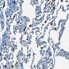 Anti-SLA Antibody