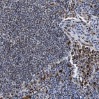 Anti-HLA-DMB Antibody