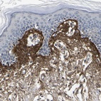Immunohistochemical staining of human skin shows high expression.
