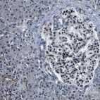 Immunohistochemical staining of human pancreas shows low expression as expected.