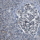 Immunohistochemical staining of human pancreas shows low expression as expected.