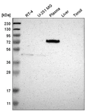 Western blot analysis in human cell line RT-4, human cell line U-251 MG, human plasma, human liver tissue and human tonsil tissue.