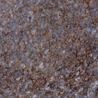Anti-RNF182 Antibody