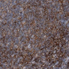 Anti-RNF182 Antibody