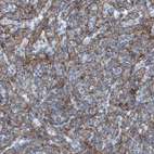 Immunohistochemical staining of human spleen shows moderate membranous positivity in cells in white pulp.